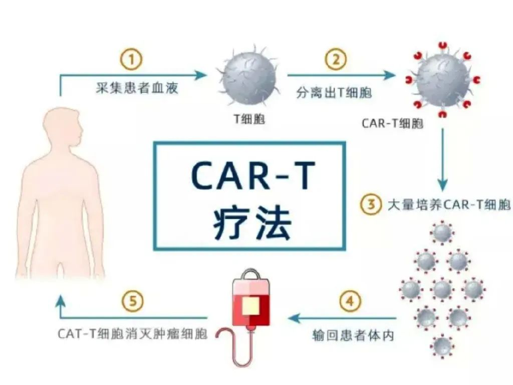 "活"的抗癌药!细胞免疫治疗法"