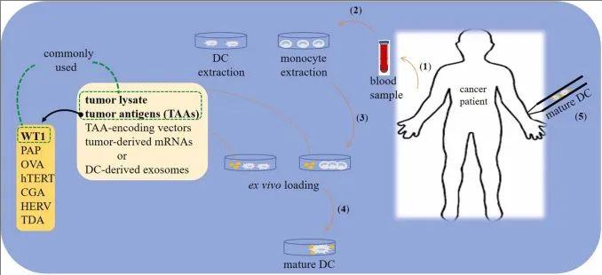 树突状细胞疫苗治疗流程