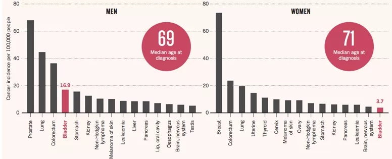 膀胱癌全球高发癌症：男性患者发病率约是女性4倍