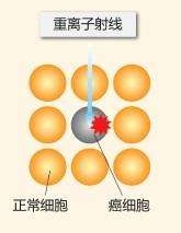 重离子线杀灭癌细胞
