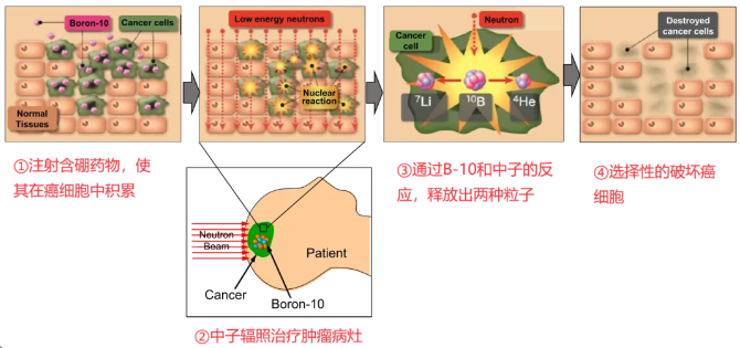 30分钟击破肿瘤?抗癌新星-硼中子疗法深入细胞内部精准绝杀,