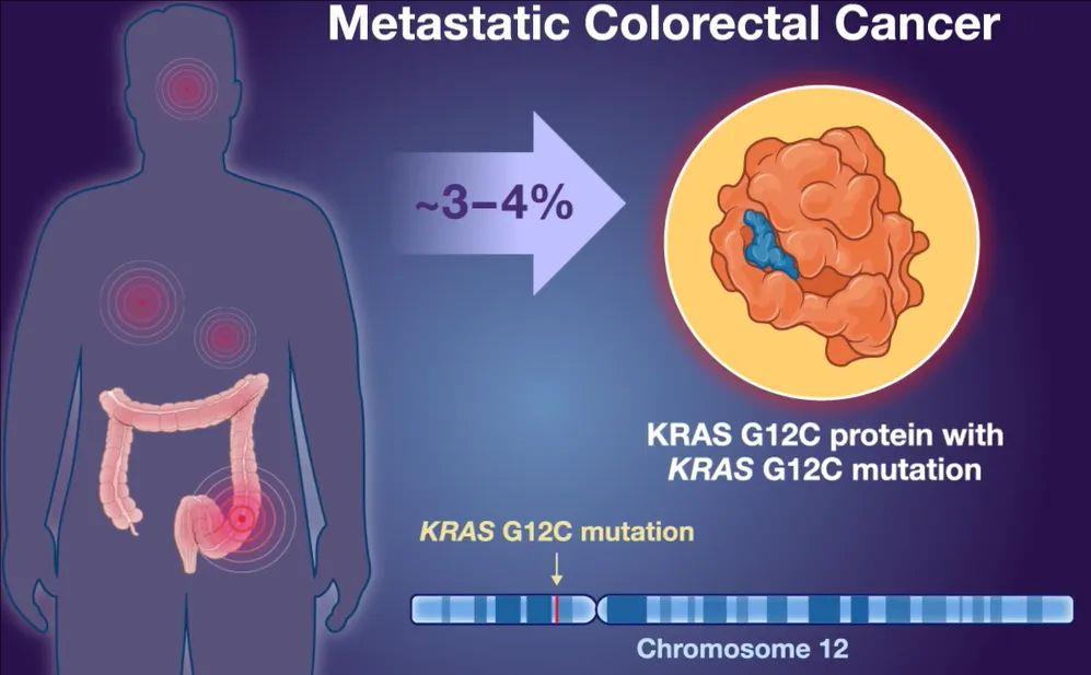 30%患者肿瘤靶病灶显著缩小​!KRAS+肠癌重磅新药202