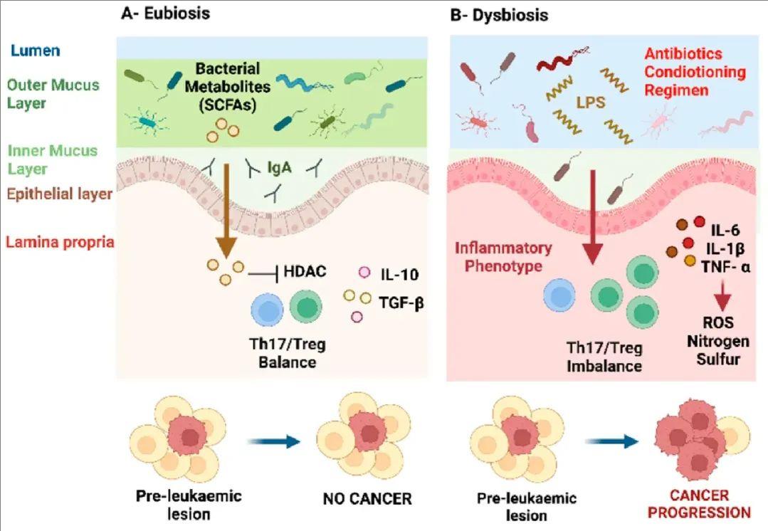 肠道菌群参与白血病进展过程的示例图